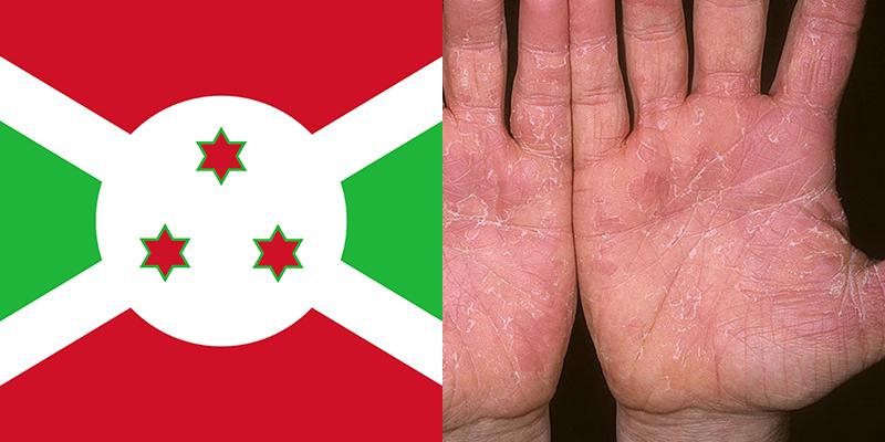 Skin Disease In Burundi