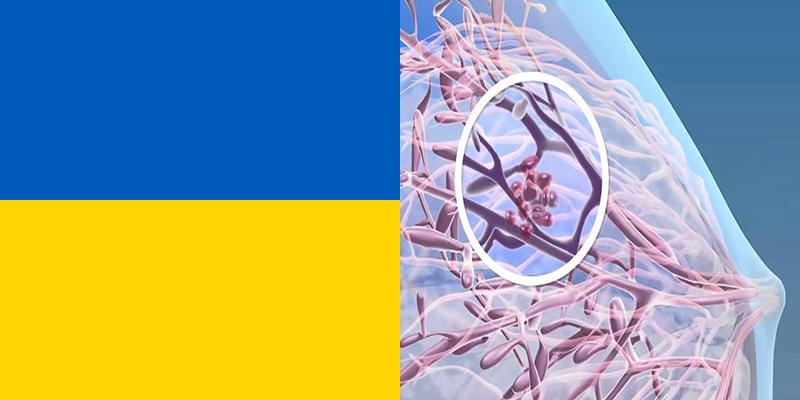 breast cancer in ukraine Breast cancer in ukraine