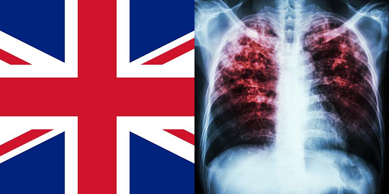 Новый туберкулез в великобритании